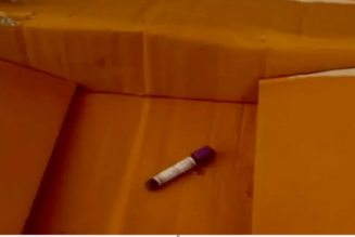 Frau behauptet, sie habe eine Phiole mit menschlichem Blut in einer Schachtel mit Stuhl erhalten, die sie bei Amazon bestellt habe