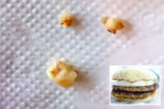 McDonald’s entschuldigt sich, nachdem ein Kunde in seinem McMuffin „Fragmente menschlicher Zähne“ gefunden hat