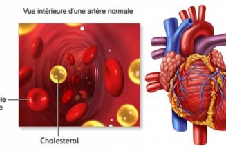 Cholesterin verursacht KEINE Herzkrankheit