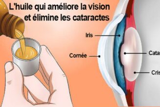 Rizinusöl verbessert das Sehvermögen und beseitigt Katarakte (wie man es verwendet)