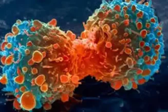 Chemotherapie Giftiges Gift für jede lebende Zelle im menschlichen Körper – tötet Krebs ab, ohne gesunde Zellen zu gefährden – Wermut ist eine wirksame Alternative zur Chemotherapie – und es ist 1000-fach…